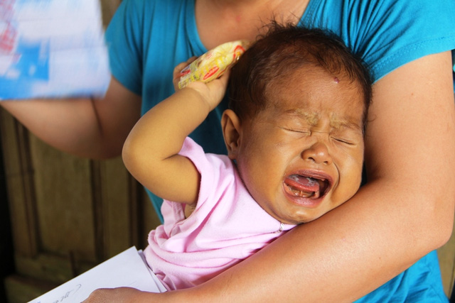 Tiếng khóc xé lòng của bé thơ 9 tháng tuổi bị teo ống mật bẩm sinh