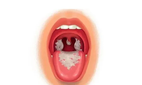 TP.HCM đủ vaccine bạch hầu để tiêm cho người dân có nhu cầu