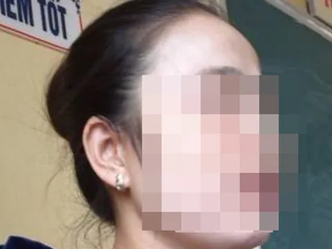 Cô giáo mầm non bị tung “ảnh nóng” lên mạng