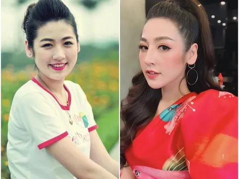 Á hậu Tú Anh vướng nghi vấn phẫu thuật thẩm mỹ