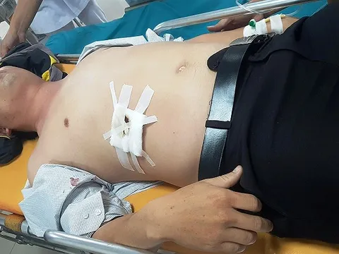 Vì sao nam sinh tấn công gây trọng thương thầy hiệu trưởng?