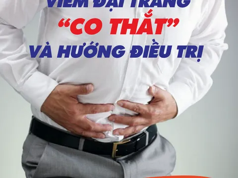 Viêm đại tràng co thắt và hướng điều trị