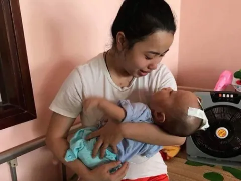 Bị mắc não úng thủy, mạng sống bé trai 8 tháng tuổi đang 'ngàn cân treo sợi tóc'