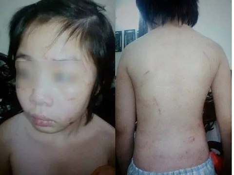 Xét xử vụ bố đẻ, mẹ kế bạo hành bé trai 10 tuổi: Trào nước mắt khi đọc cáo trạng