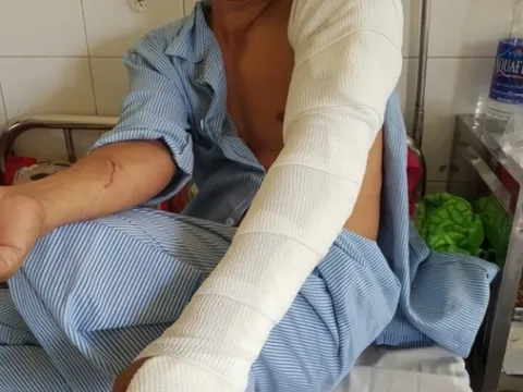 Xông vào nhà chém người vì chỗ để xe