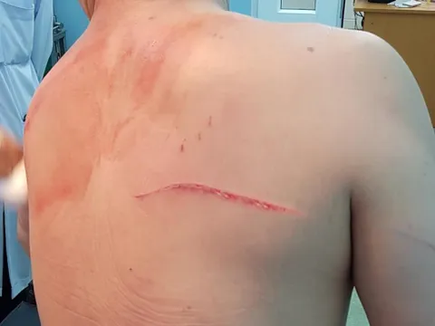 Bắt tạm giam vợ bác sĩ Chiêm Quốc Thái