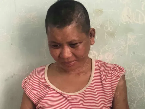 Cô gái 9X làm thuê tố bị chủ nhà ngáo đá tra tấn dã man