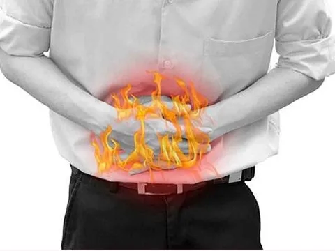 Dấu hiệu bệnh trào ngược dạ dày - Bạn chớ bỏ qua!