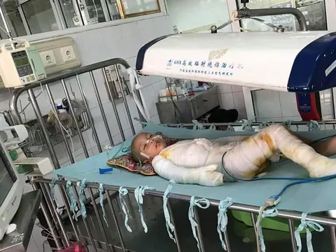 Cháu Đạt chưa được ghép da, gia đình đã sức cùng lực kiệt