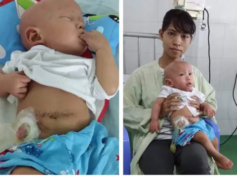 Xót xa bé gái 1 tuổi nặng 5kg, mắc 3 bệnh hiểm nghèo