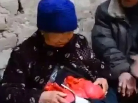 Khó tin cụ bà sống suốt 20 năm với... ruột lòi ra ngoài cơ thể