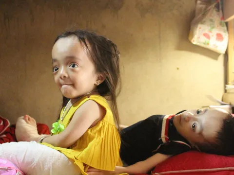 Hai anh em mắc bệnh xương thủy tinh vượt lên số phận