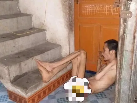 Xót xa gia cảnh một bệnh nhân bị u máu