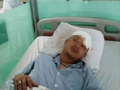 Thái Bình: Bị đánh trọng thương sau khi đến công ty đòi tiền lương