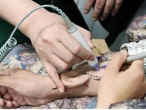 Người đàn ông Trung Quốc "mọc" tai trên tay