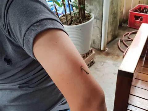 Chủ quán cà phê bị đối tượng lạ mặt 'xử' bắn