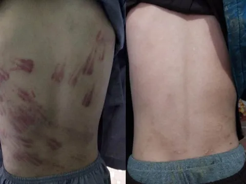 Sự thật bé trai mồ côi bị sư thầy đánh tím khắp người tại Thanh Hóa