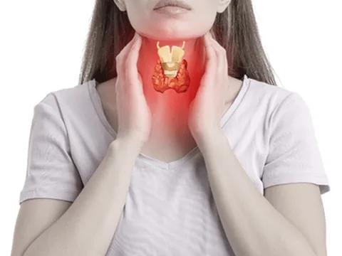 Chuyên gia Mỹ chỉ cách kiểm tra bệnh tuyến giáp tại nhà với cốc nước lọc