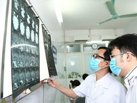Bất ngờ phát hiện bệnh về não rất nhiều người Việt bị chỉ qua cơn đau đầu