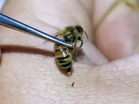 Thực hư thông tin nọc ong chữa ung thư