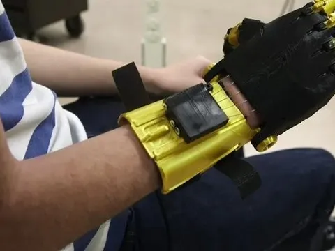 Cả lớp cùng chế tay robot cho bạn học khuyết tật