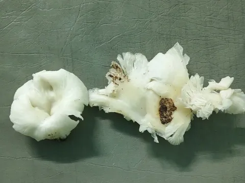 Kịp thời cứu sống 3 người dân bị ngộ độc nấm rừng lạ