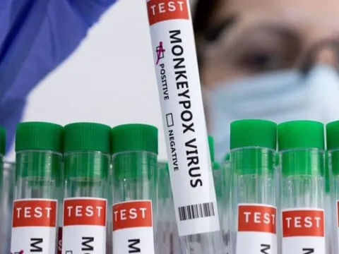 Bộ Y tế hướng dẫn các biện pháp phòng, chống tạm thời với bệnh đậu mùa khỉ