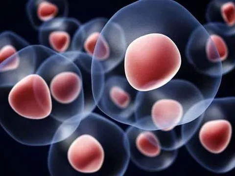 Ứng dụng của tế bào gốc từ máu cuống rốn trong điều trị các biến chứng ở trẻ sinh non