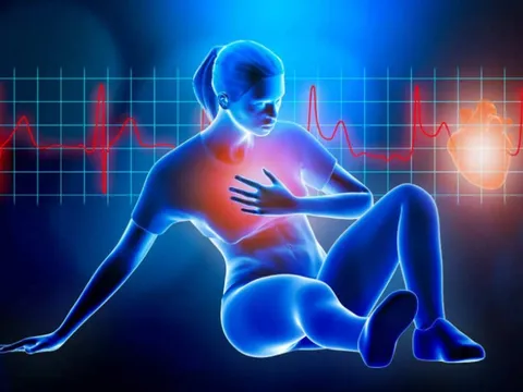 Không kiểm soát cholesterol hiệu quả có thể gây ra các bệnh về tim