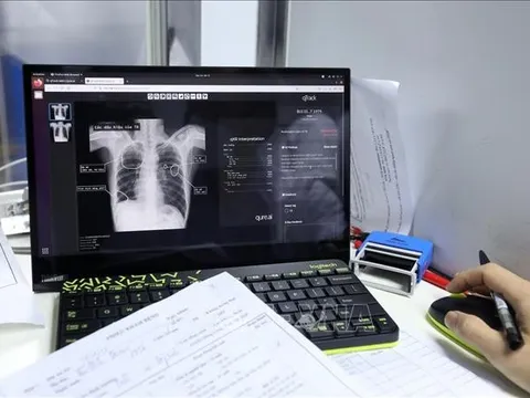 Tỷ lệ mắc lao ở người trẻ cao hơn 20 lần so với nhóm tuổi khác