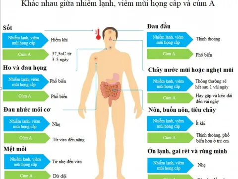 Cúm A và viêm mũi họng cấp - phân biệt như thế nào?