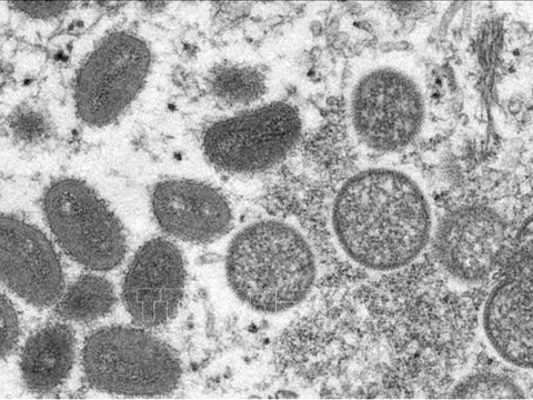 Giám sát dịch tại cửa khẩu để chủ động phòng, chống bệnh đậu mùa khỉ