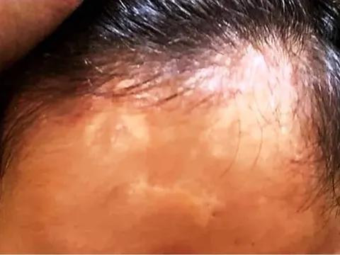 Vụ gửi con chữa bệnh, nhận về hũ tro cốt: Thêm một gia đình tại Huế tố giác