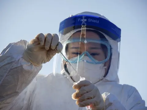 Xuất hiện loại virus giống HIV, nguy cơ lây sang người