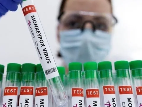 Có nên tiêm vắc xin ngừa đậu mùa khỉ?