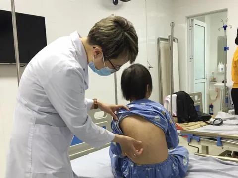 Không chủ quan khi trẻ bị viêm da cơ địa những ngày trời nồm