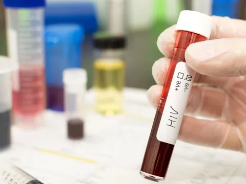 Người thứ 5 trên thế giới được chữa khỏi HIV
