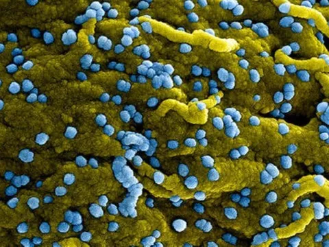 Bệnh do virus Marburg khó chẩn đoán