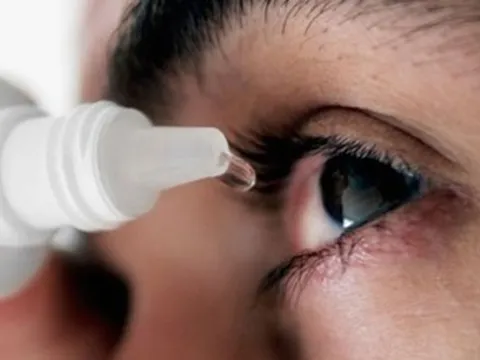 Bệnh đau mắt đỏ có thể gây biến chứng nặng nề