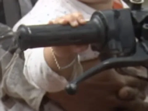 Vô tình vặn tay ga xe máy, bé 4 tuổi bị tai nạn nguy kịch, đa chấn thương