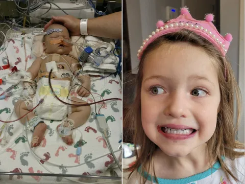 Bé gái chào đời với một nửa trái tim: Vẫn nỗ lực sống mỗi ngày