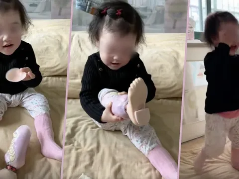 Xúc động khoảnh khắc cô bé 2 tuổi tự mình đeo chân giả