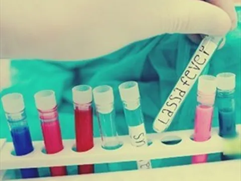 155 người tử vong do dịch sốt Lassa ở Nigeria