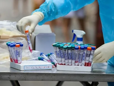 TP.HCM ghi nhận ca bệnh đậu mùa khỉ đầu tiên