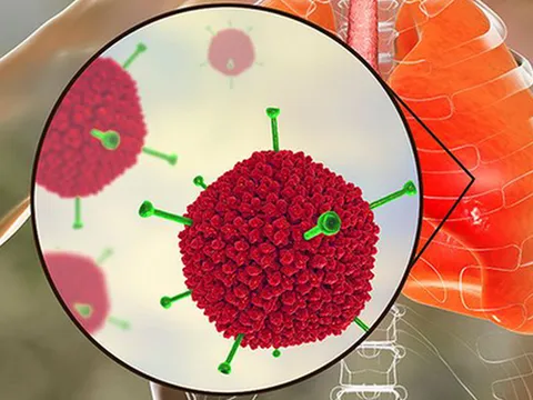 Thêm 1 bệnh nhi tử vong do mắc Adeno virus: Tiền sử khỏe mạnh, không bệnh nền