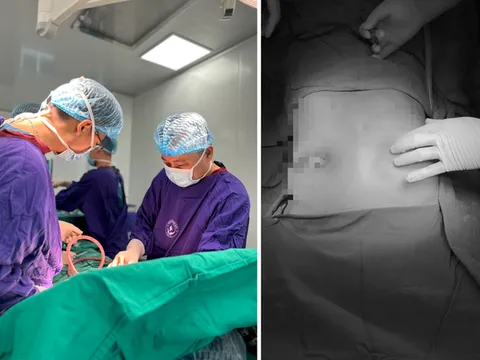 Bác sĩ cảnh báo những biến chứng sau tiêm filler nâng ngực, mũi, xóa nhăn...