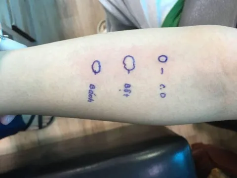 Nguyên nhân khiến cô gái trẻ ngất xỉu, phát ban sau khi ăn bánh mì