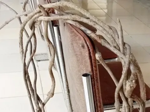 Xác định nguyên nhân khiến 7 người ở Nghệ An nguy kịch phải nhập viện cấp cứu