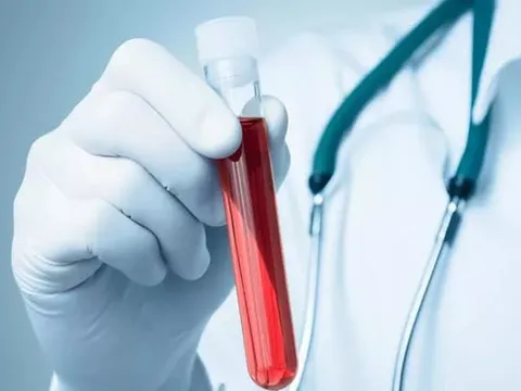 Hai người bệnh đầu tiên trên thế giới được truyền máu nhân tạo