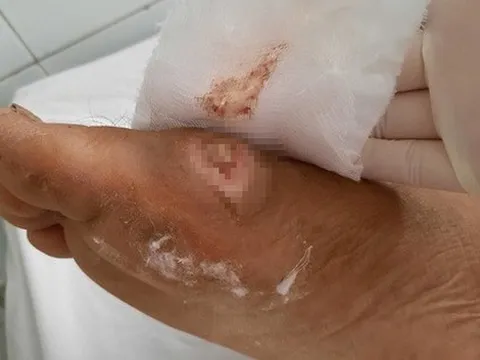 3 người bất ngờ phát hiện mắc bệnh Whitmore, có bé suy tạng phải thở máy